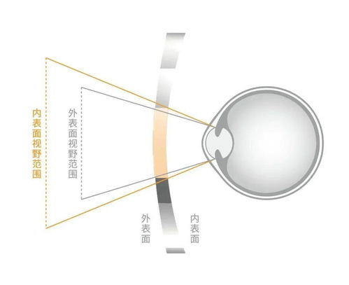 专为中国孩子设计 明月镜片推出‘轻松控’青少年近视管理镜片